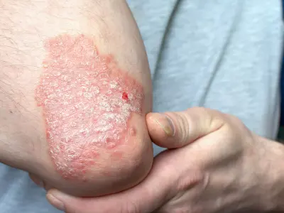 Aarogyam clinic Jiyanpur